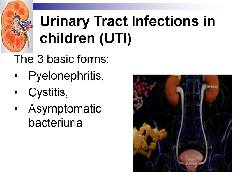 Urinary Tract Infections in children (UTI) The 3 basic forms:  Pyelonephritis,  Cystitis,
